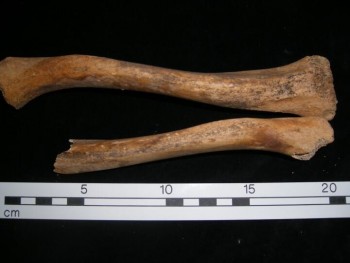 Figure 4: Residual rickets, marked bowing of femur and tibia from St Brides Lower. Museum of London 2019, extracted 18.10.19.